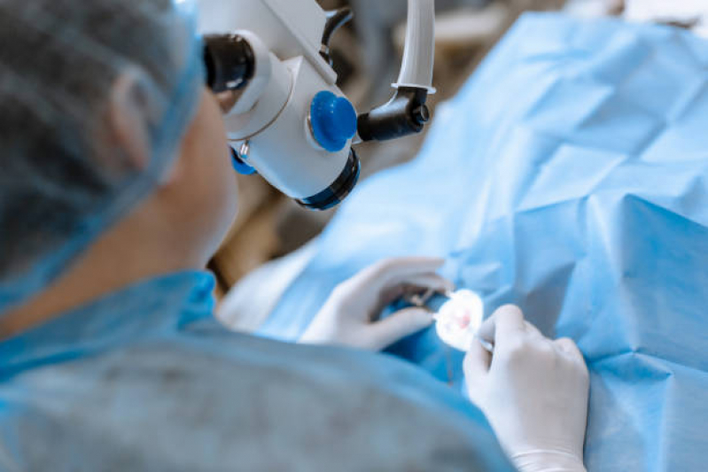 Cirurgia para Cataratas a Laser Alagoas - Cirurgia de Catarata Vila Clementino