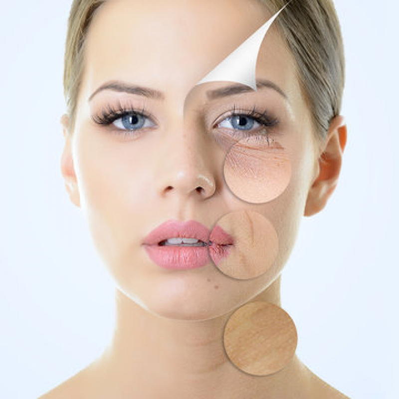 Estética para Olhos Perdizes - Estética Facial Masculina