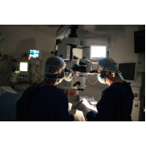 cirurgia catarata a laser agendar Vila Monte Alegre