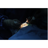 cirurgia de facectomia clínica Sergipe