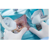 cirurgia para bolsas de gordura nos olhos Próximo a travessa Doutora Virgínia Morikawa