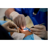cirurgia para facectomia com implante de lente clínica Próximo a praça Ciríaco Grisanti