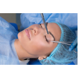 clínica especialista em cirurgia plástica para pálpebra Tibiriçá
