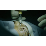 clínica que faz cirurgia lente intra ocular Chácara Santo Antônio