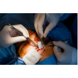 onde fazer cirurgia para facectomia com implante de lente Chácara Santo Antônio