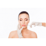 preenchimento facial para tratamento de rugas Vila Nova Concição