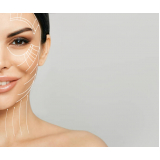 tratamento de rejuvenescimento para rosto marcar Sacoma